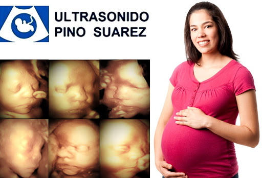 Ultrasonido Pino Suárez