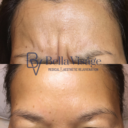 Explore alzheimer's tattoo ideas, creative tattoo ideas in Lakeland, available at Bella Visge Medical & Aesthetic Rejuvenation