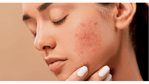 7995 66th St N, Pinellas Park, FL 33781, USA