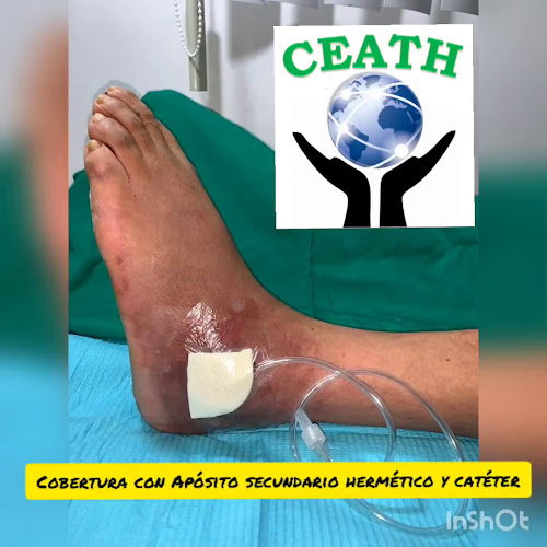 Comentarios y opiniones de Ceath Centro Especializado en Atencion de Traumatologia y Heridas