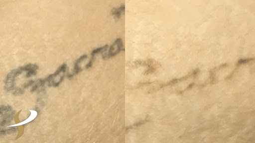 Explore cigarette tattoo ideas, creative tattoo ideas in Spokane, available at Premier Body and Laser