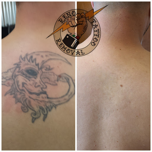 Explore tattoo ideas gangster, creative tattoo ideas in Reno, available at Reno Tattoo Removal