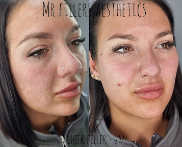 Mr. & Mrs. Fillers Aesthetics - Mr. & Mrs. Fillers Aesthetics