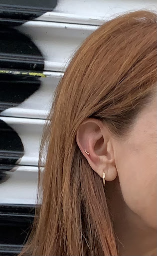 Explore tattoo scar ideas, creative tattoo ideas in Brooklyn, available at Live By The Sword Tattoo