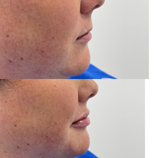 Explore easy cover up tattoo ideas, creative tattoo ideas in Owensboro, available at The Skin Lab