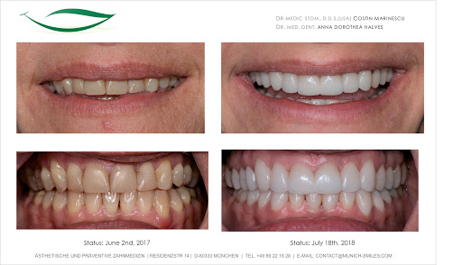Munich Smiles - Costin Marinescu, Dr-Medic Stom, DDS - Advanced Aesthetic and Preventive Dentistry