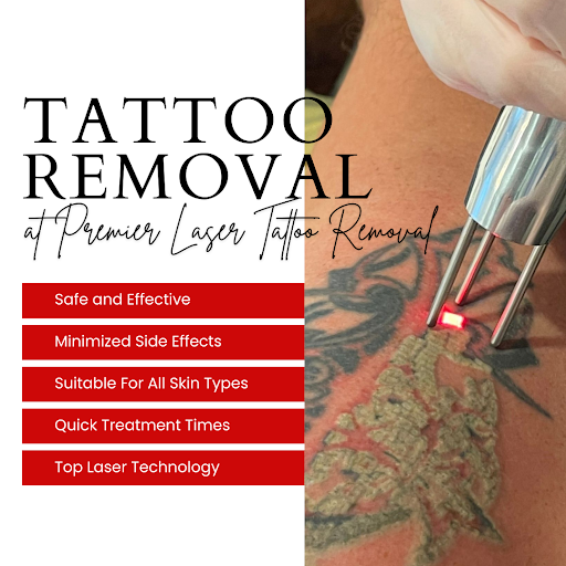 Explore machine tattoo ideas, creative tattoo ideas in Tomball, available at Premier Laser Tattoo Removal