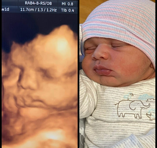A Little Insight 3D 4D 5D Ultrasound image