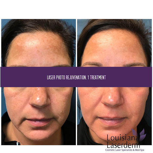 Explore the flash tattoo ideas, creative tattoo ideas in Baton Rouge, available at Louisiana Laserderm