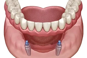Whitehills Dental Practice image
