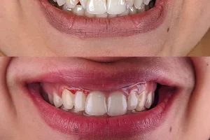 Dental Art Space عيادة د.احمد سلامة لتجميل و تقويم الاسنان image