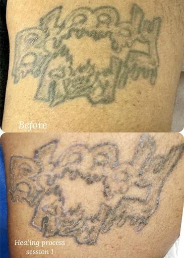 Explore tree tattoo ideas, creative tattoo ideas in Savannah, available at Haute Brows. Cosmetic Tattoo