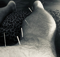 Acupuncture Alchemy - Photo 5 - Car repair in St. Petersburg, FL, St. Petersburg