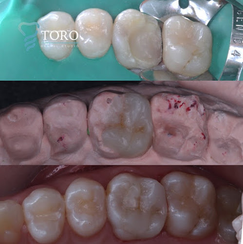 Opiniones de TORO DENTAL STUDIO en Portoviejo - Dentista