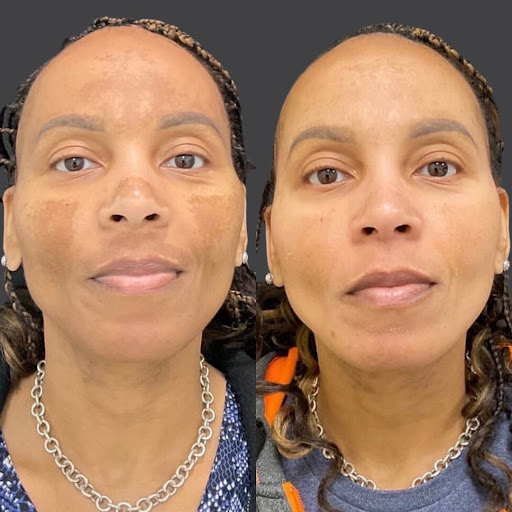 Explore logging tattoo ideas, creative tattoo ideas in Whittier, available at Skin Perfect Medical Aesthetics