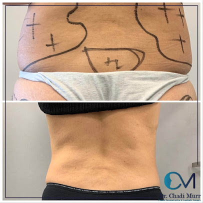Dr. Chadi Murr - Dr. Chadi Murr