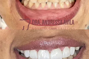 Dra. Andressa Ávila Odontologia Estética image