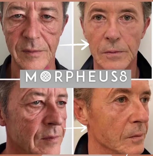 Explore california state tattoo ideas, creative tattoo ideas in Powell, available at A Younger You Aesthetics