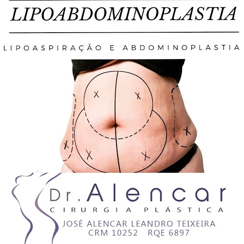 Avaliações sobre Dr. José Alencar Cirurgia Plástica Fortaleza em Fortaleza - Cirurgião
