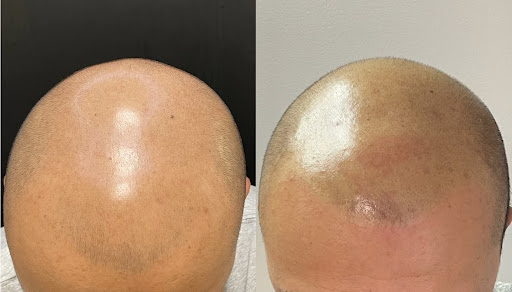 Explore face tattoos above eyebrow tattoo ideas, creative tattoo ideas in Grand Blanc, available at Pretty N Ink Permanent Cosmetic Studio