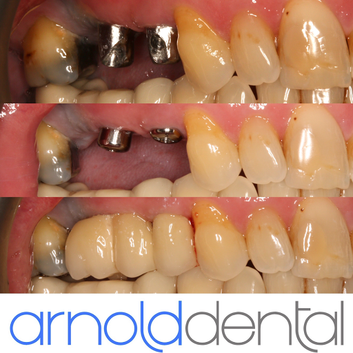 Arnold Dental & Implant Centre