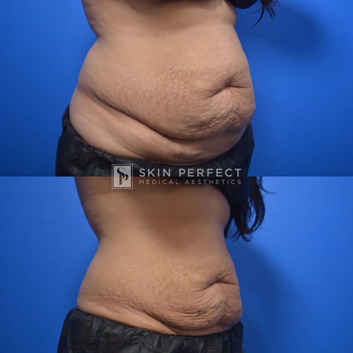 Explore personality disorder bpd tattoo ideas, creative tattoo ideas in Whittier, available at Skin Perfect Medical Aesthetics