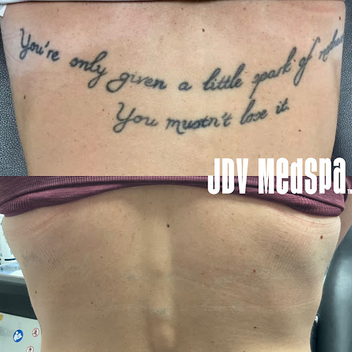 Explore tattoo ideas upper back, creative tattoo ideas in Canton, available at JDV Med Spa
