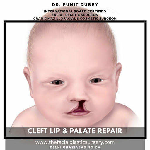 Dr. Punit Dubey: Facial Plastic Surgery