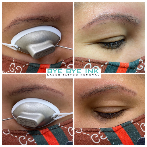 Explore dog collar tattoo ideas, creative tattoo ideas in Middle Village, available at Bye Bye Ink Laser Tattoo Removal