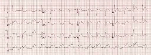 Salman Akhtar, MD, Cardiovascular Specialists