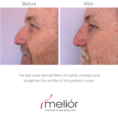 عيادات ميليور – ستامفورد - Melior Clinics – Stamford