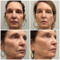 Haute Beauty Aesthetics - Photo 4 - Car repair in Fairview, TX, McKinney