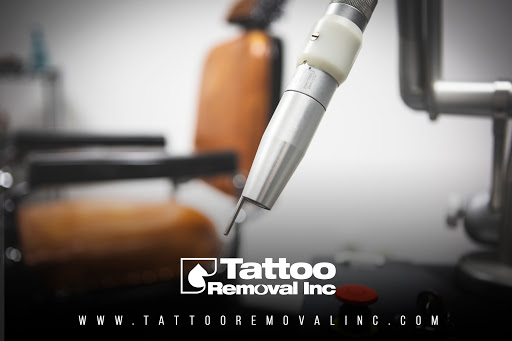 Explore idea tattoo shop, creative tattoo ideas in South Gate, available at Tattoo Removal Inc