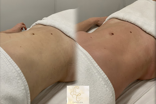 Logo da empresa - Andrezza Campos Estética Corporal e Facial