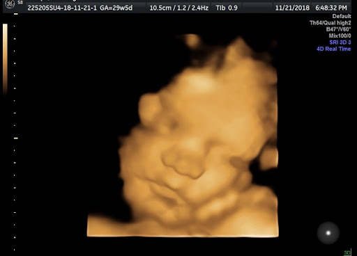 Baby Envision 4D Ultrasound of Grand Rapids