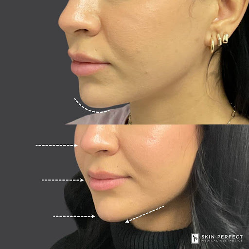 Explore kiss lip tattoo ideas, creative tattoo ideas in Whittier, available at Skin Perfect Medical Aesthetics