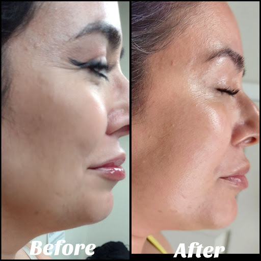 Explore tattoo cover ideas, creative tattoo ideas in Brighton, available at Valkyrie Tattoos