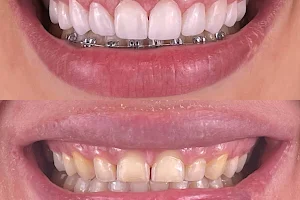 Grená Odontologia Estética image