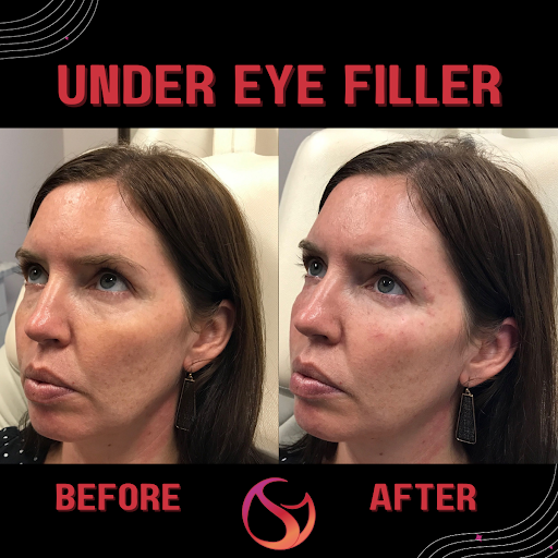 Explore mens filler tattoo ideas, creative tattoo ideas in Cincinnati, available at The Dermatology, Laser & Vein Center