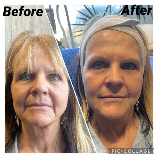 Explore tattoo ideas for breast cancer ribbon, creative tattoo ideas in Idaho Falls, available at Senza Skin Spa Senza Weight Loss
