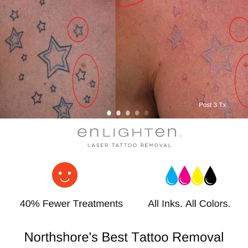 Explore mystic tattoo ideas, creative tattoo ideas in Covington, available at Northshore Tattoo Removal