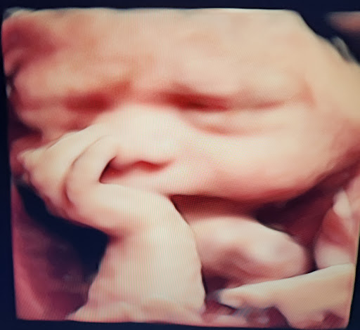 Baby Wave 4D Ultrasound image