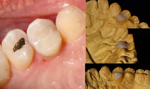 Bitehaus Dental |Dra.Hylse Najera