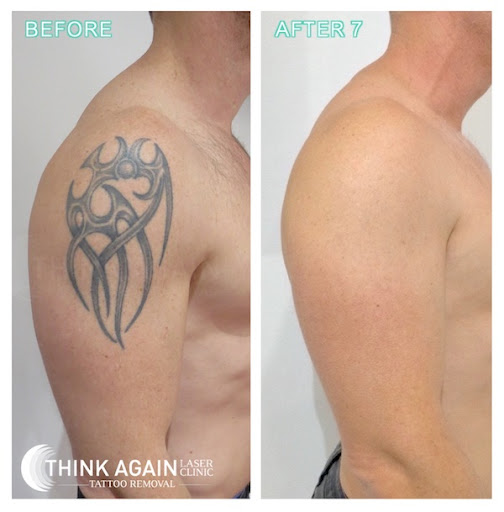 Think Again Laser Clinic - Castle Hill