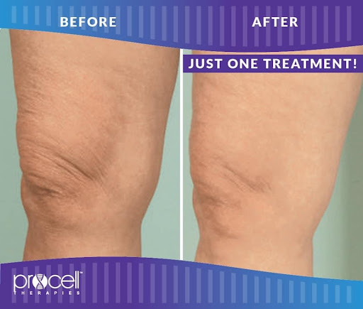 Explore thistle tattoo ideas, creative tattoo ideas in Savannah, available at Haute Brows. Cosmetic Tattoo