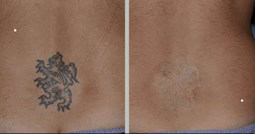 Explore mens knee tattoo ideas, creative tattoo ideas in Las Vegas, available at Black Inc Laser Tattoo & Hair Removal