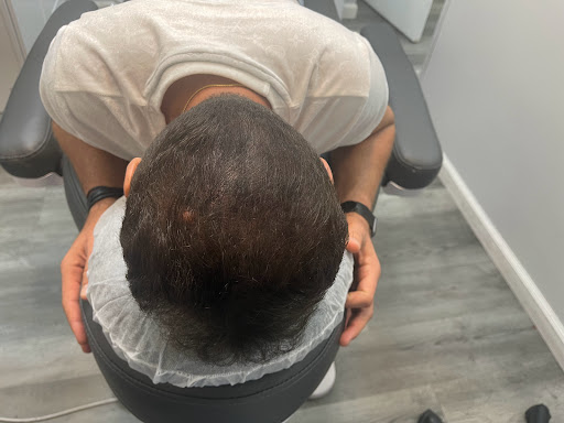 Explore hibiscus tattoo ideas, creative tattoo ideas in Roseville, available at NuHair Ink. Scalp MicroPigmentation & Aesthetic Clinic of Sacramento