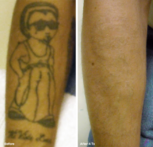 Explore humble tattoo ideas, creative tattoo ideas in Fort Myers, available at Laser Tattoo Removal by Tatt Cemetery