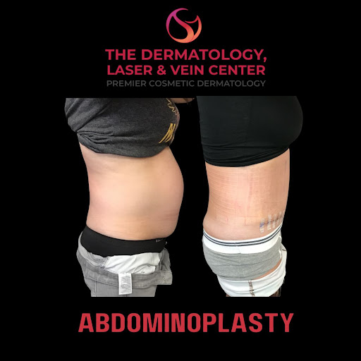 Explore michael jackson tattoo ideas, creative tattoo ideas in Cincinnati, available at The Dermatology, Laser & Vein Center