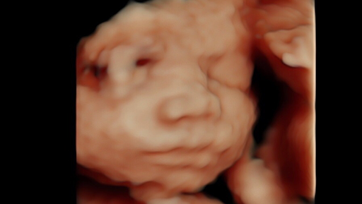 Prenatal Miracles 3D /4D HD Live Ultrasound Studio
